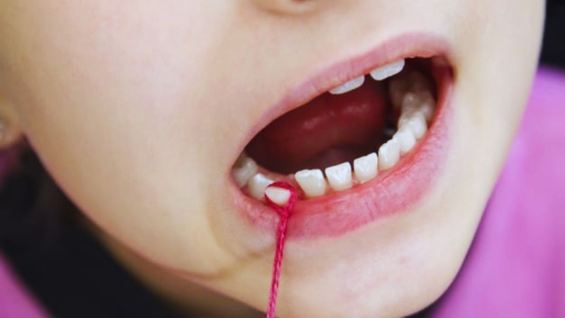 Safe and Painless Methods to Remove a Tooth