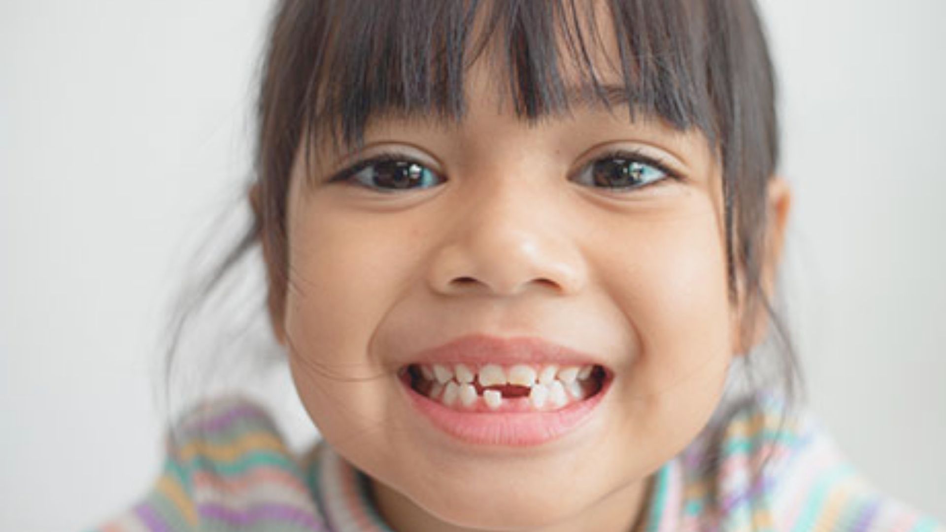 When Baby Gap Teeth Are a Concern