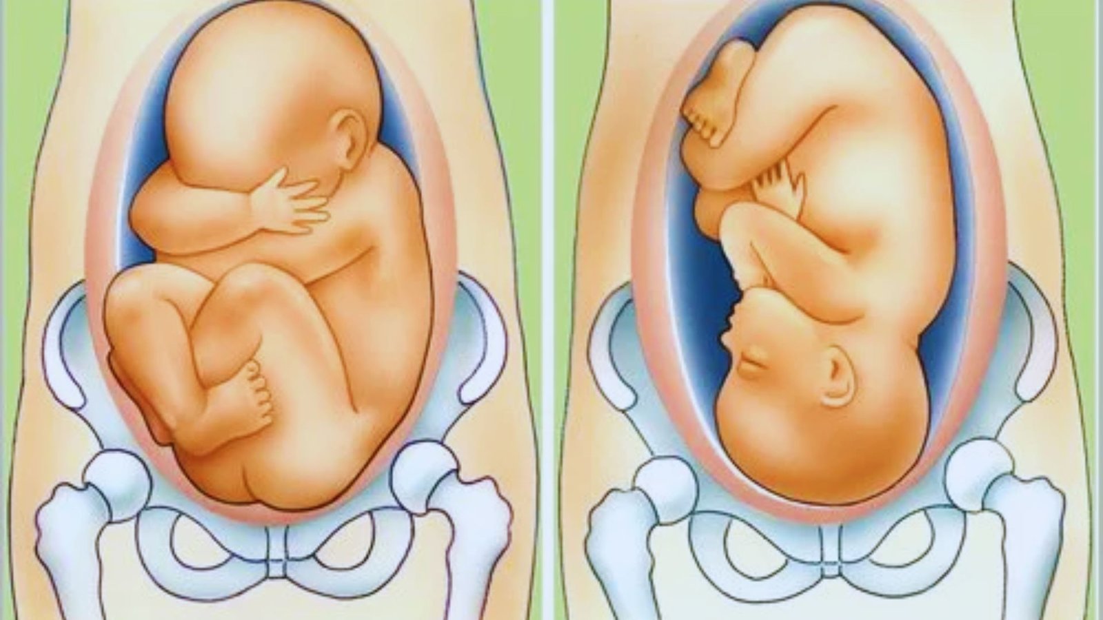 How to Turn Baby Head