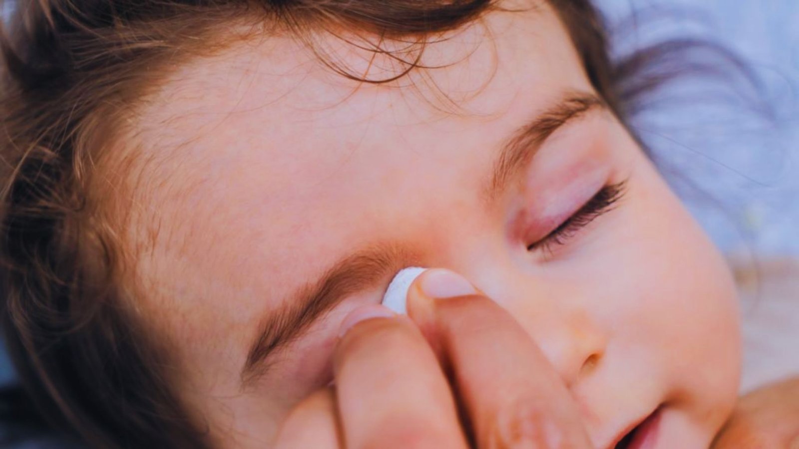 One Swollen Eye vs Both Eyes: What It May Mean