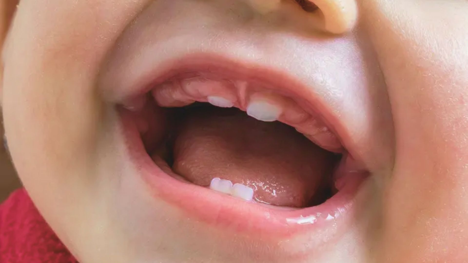 Why Babies Have Gaps Between