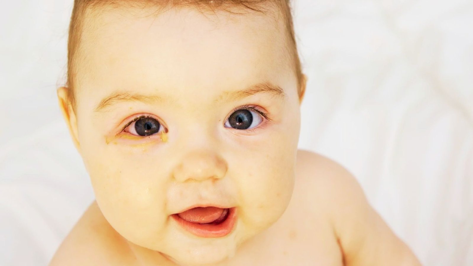 Allergies or Sensitivities