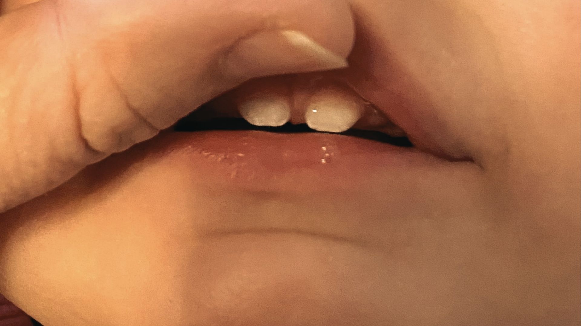 Close-up of a child’s mouth with an adult finger lifting the upper lip to reveal the gum.