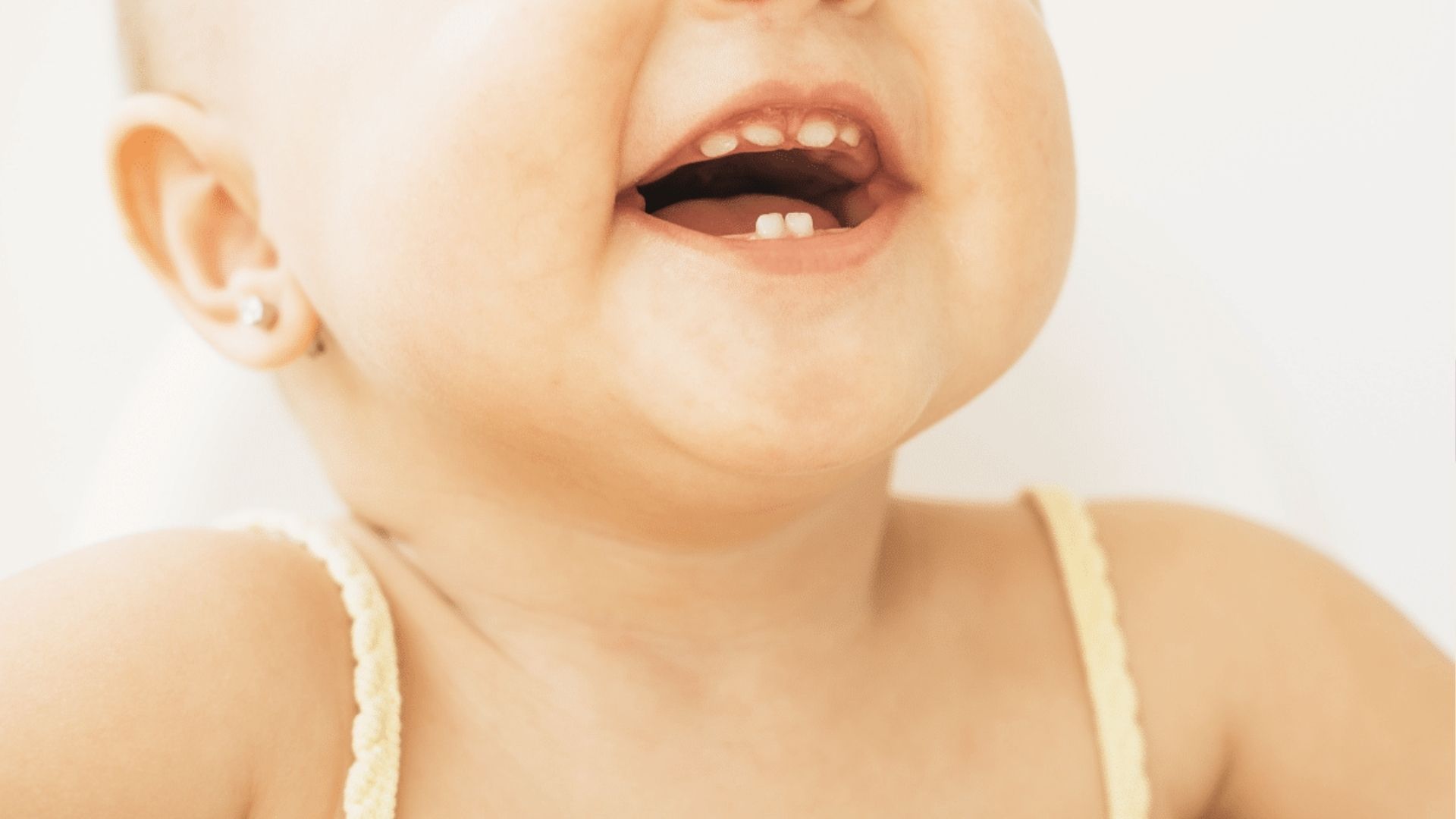 Happy baby in a yellow top laughing with three top teeth and two bottom teeth visible.