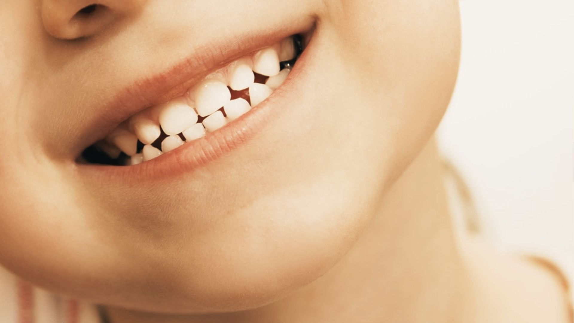 Side view of a toddler smiling wide to display a full set of upper and lower baby teeth.