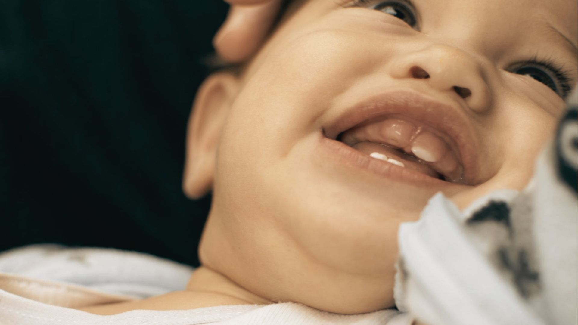 A smiling baby with visible upper and lower teeth has the upper lip slightly lifted.