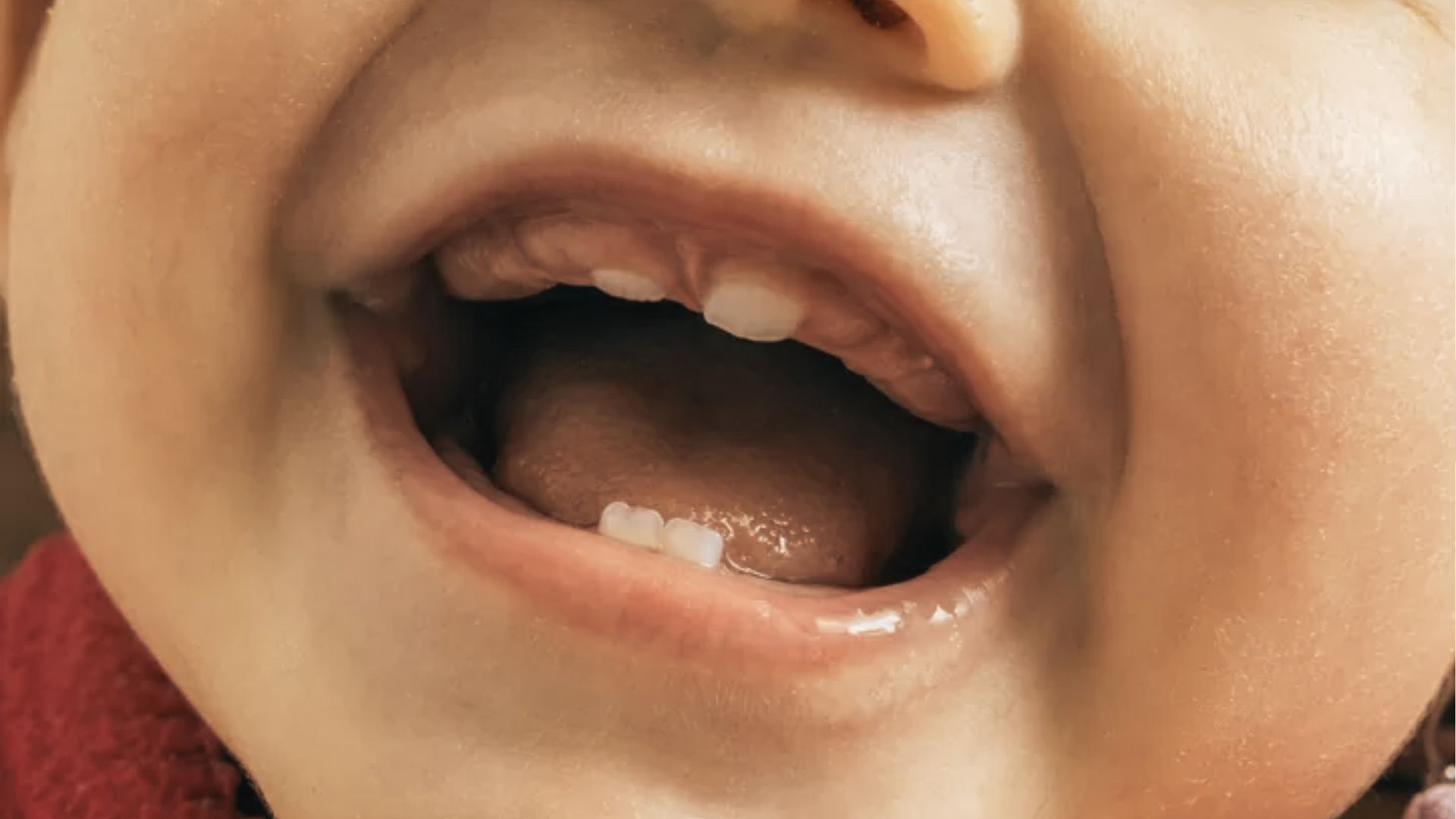 Baby with mouth wide open, showing two top teeth and two bottom teeth just erupted.