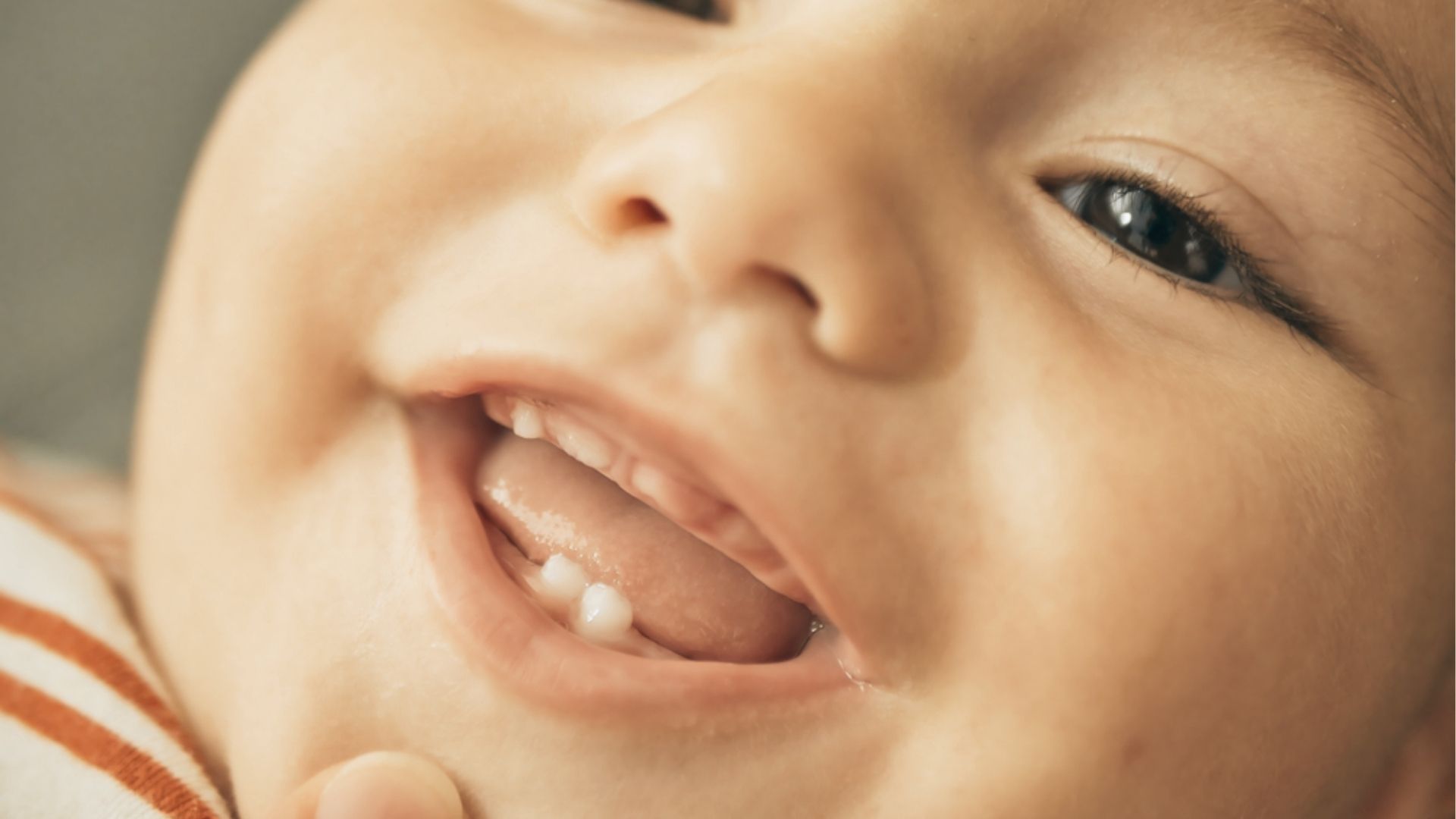 Close-up of a smiling baby in a striped outfit showing two tiny bottom teeth and one top tooth emerging.
