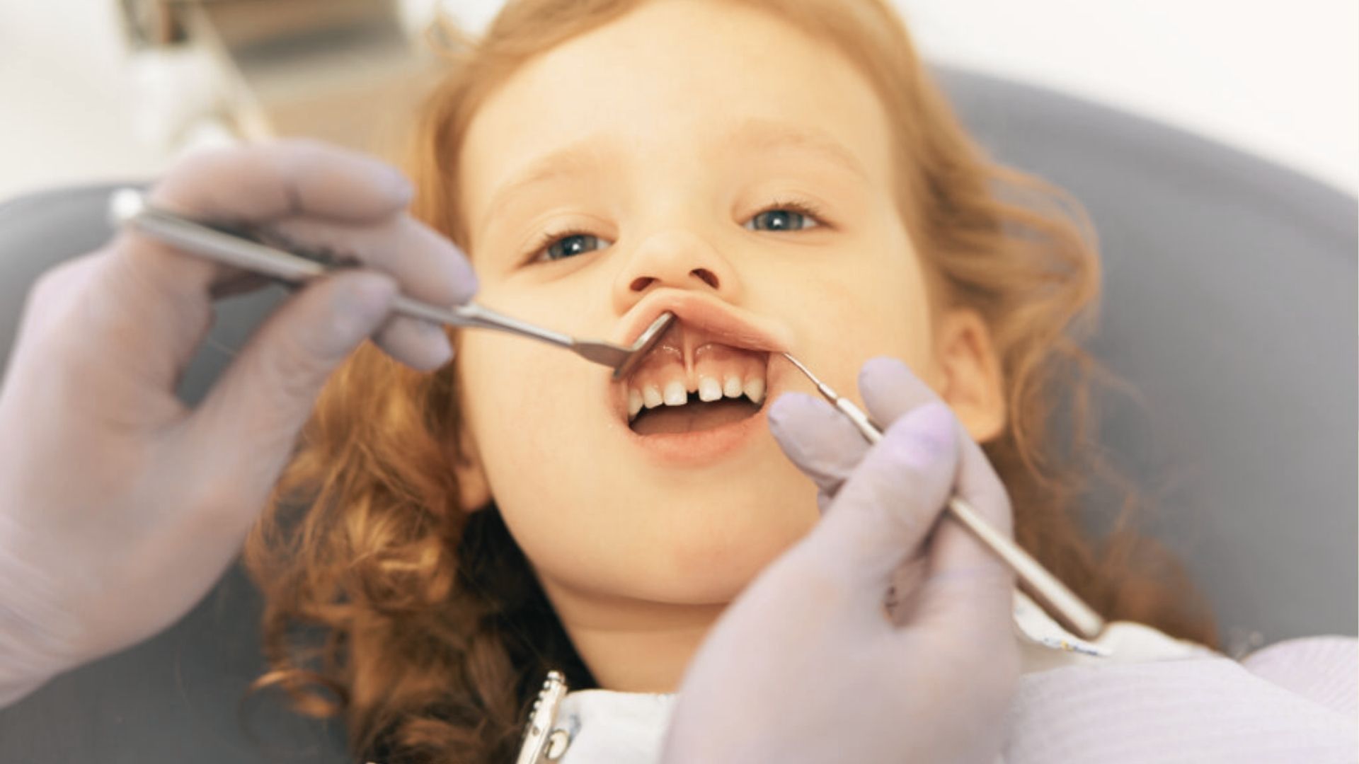 A pediatric dentist lifts a young girl’s upper lip with dental tools during an oral exam.